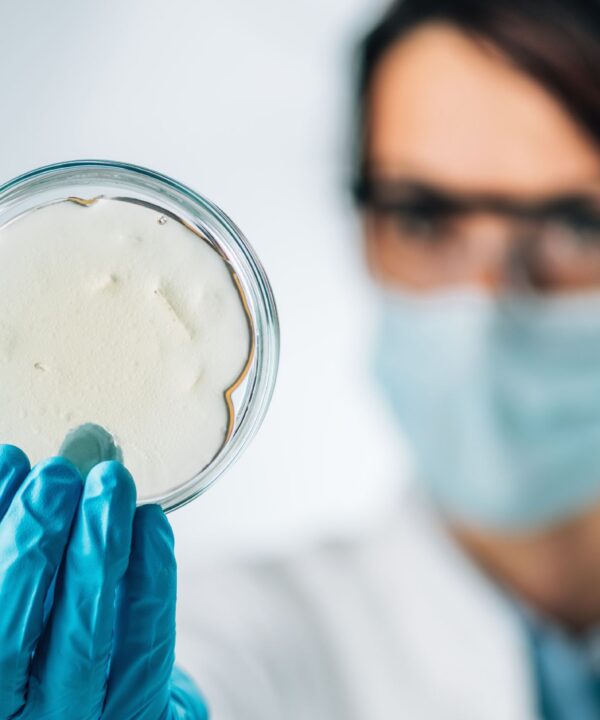 Scientist holding a petri dish containing Aeromonas bacteria, focusing on innovative solutions for aquaculture pathogen management.