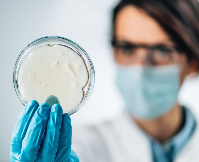 Scientist holding a petri dish containing Aeromonas bacteria, focusing on innovative solutions for aquaculture pathogen management.