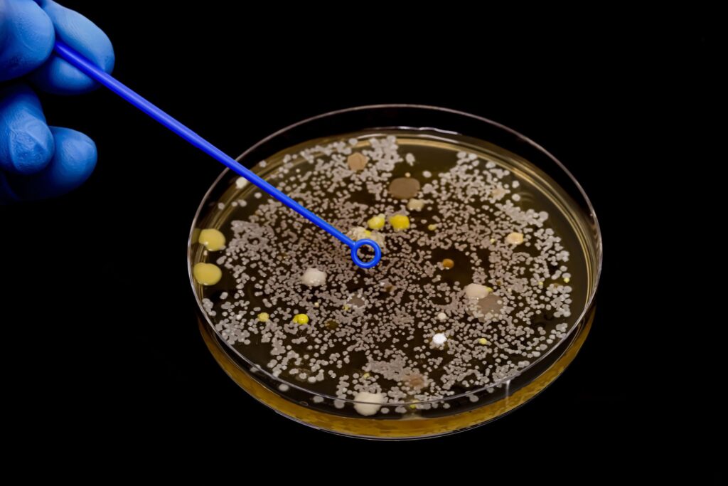 Petri dishes displaying cultures of drug-resistant E. Coli bacteria, highlighting the challenges of antibiotic resistance.