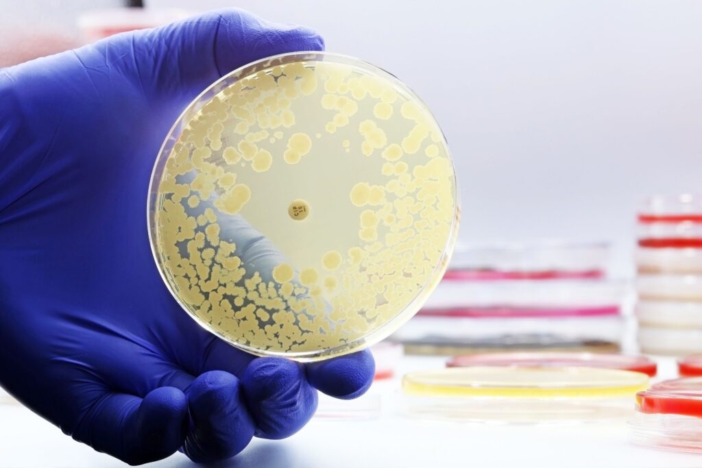 Petri dishes showing cultures of drug-resistant Klebsiella bacteria, emphasizing antibiotic resistance in healthcare.