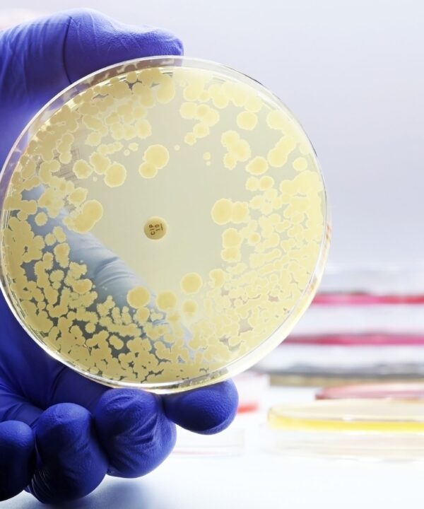 Petri dishes showing cultures of drug-resistant Klebsiella bacteria, emphasizing antibiotic resistance in healthcare.