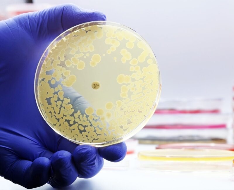 Petri dishes showing cultures of drug-resistant Klebsiella bacteria, emphasizing antibiotic resistance in healthcare.