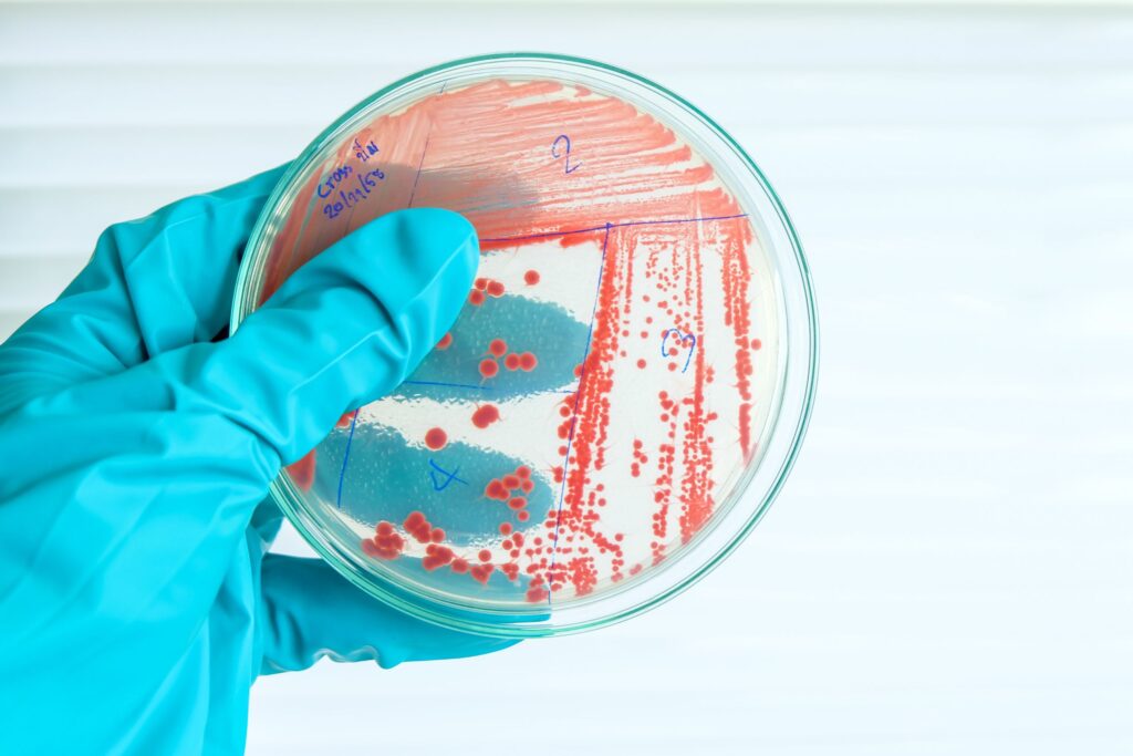 Scientist holding a petri dish containing Mycobacterium bacteria, focusing on innovative solutions for aquaculture pathogen management.