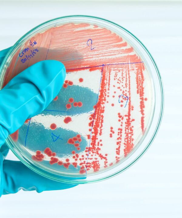 Scientist holding a petri dish containing Mycobacterium bacteria, focusing on innovative solutions for aquaculture pathogen management.