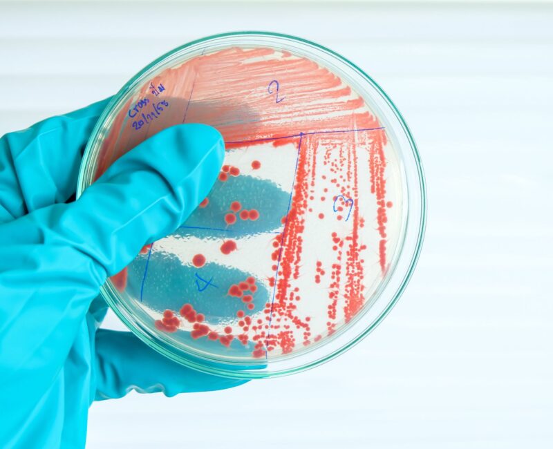 Scientist holding a petri dish containing Mycobacterium bacteria, focusing on innovative solutions for aquaculture pathogen management.