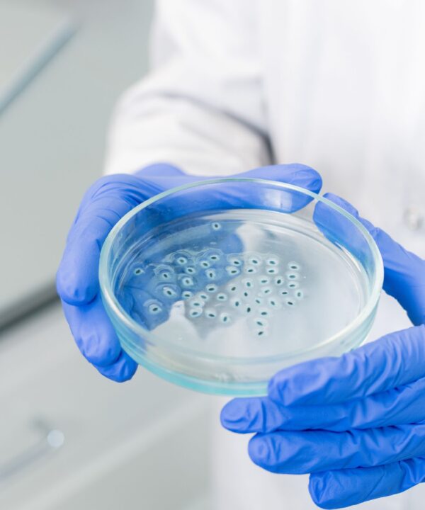 Scientist's hand holding a petri dish containing Pseudomonas bacteria, emphasizing research on pathogen management.