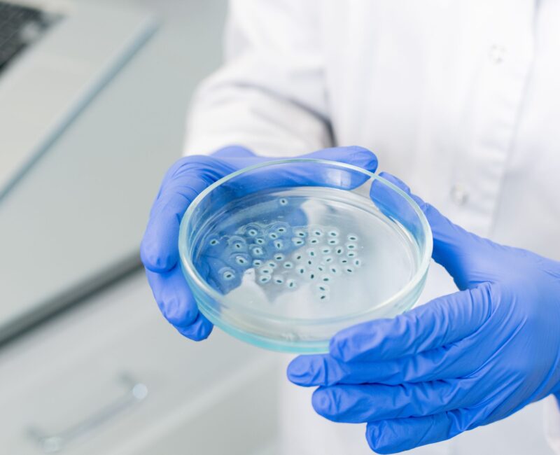 Scientist's hand holding a petri dish containing Pseudomonas bacteria, emphasizing research on pathogen management.