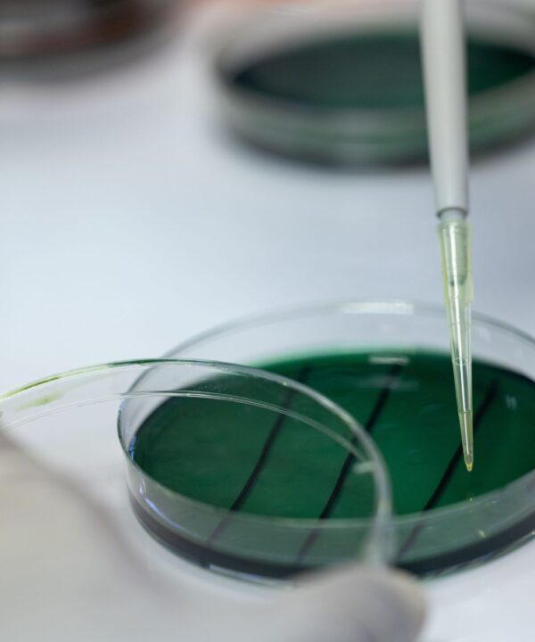 Close-up view of Vibrio bacteria in a lab, emphasizing research on aquaculture pathogens.