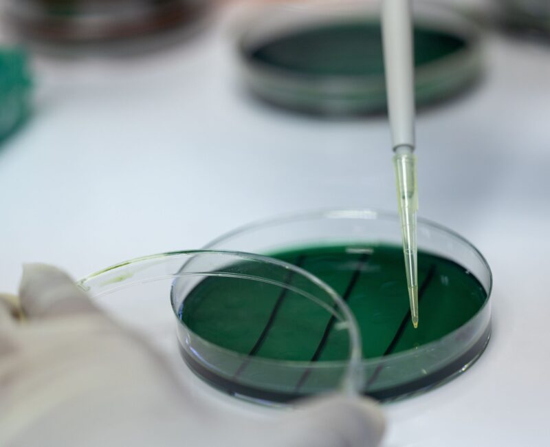 Close-up view of Vibrio bacteria in a lab, emphasizing research on aquaculture pathogens.